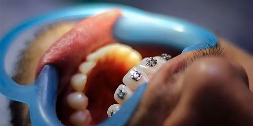 Level UP Orthodontics for the dental Hygienist and OHT -Sydney