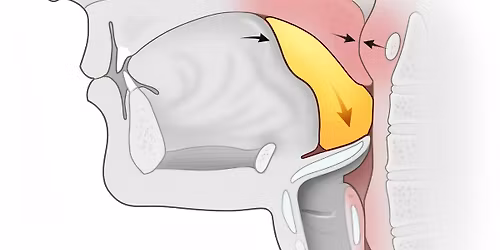 Dyphagia Awareness Symposium 2026