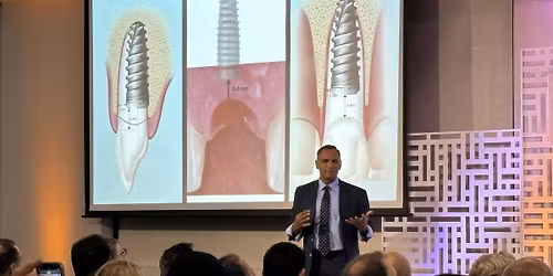 Full-Arch Implant Symposium