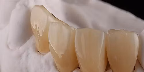 The Simplicity of Zirconia for Complex Restorative Cases
