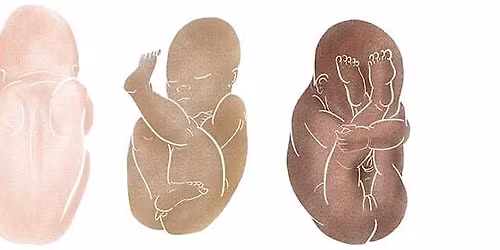 Physiological Breech Birth Training Day - Stoke Madeville