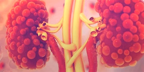 End Stage Kidney Disease in Palliative Care