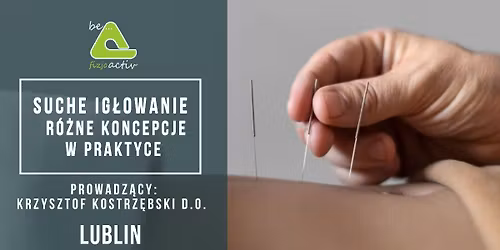 Suche IG\u0141OWANIE - r\u00f3\u017cne koncepcje w praktyce