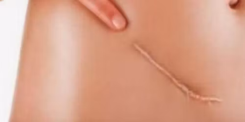 \u041e\u0441\u0442\u0435\u043e\u043f\u0430\u0442\u0438\u0447\u043d\u0438 \u0444\u0430\u0441\u0446\u0438\u0430\u043b\u043d\u0438 \u043a\u043e\u0440\u0435\u043a\u0446\u0438\u0438. \u041a\u043e\u0440\u0435\u043a\u0446\u0438\u044f \u043d\u0430 \u0448\u0435\u0432\u043e\u0432\u0435 \u0438 \u0441\u0440\u0430\u0441\u0442\u0432\u0430\u043d\u0438\u044f. \u0421\u0442\u0440\u0430\u0442\u0435\u0433\u0438\u044f \u0438 \u0432\u0438\u0434\u043e\u0432\u0435