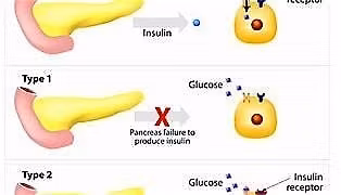 Diabetes Masterclass