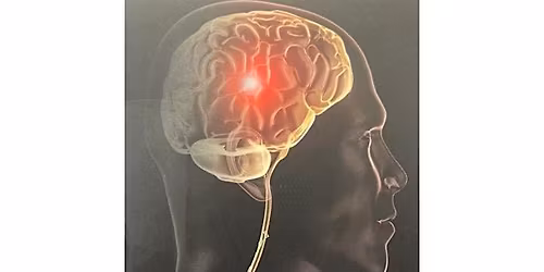 Brain Plasticity in Health and Disease