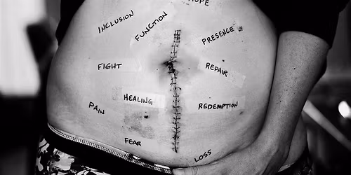 Fascial Approaches: Scar Tissue Adhesion Workshop