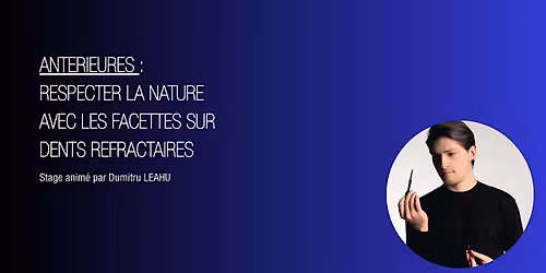 Ant\u00e9rieures : respecter la nature avec les facettes sur dents r\u00e9fractaires