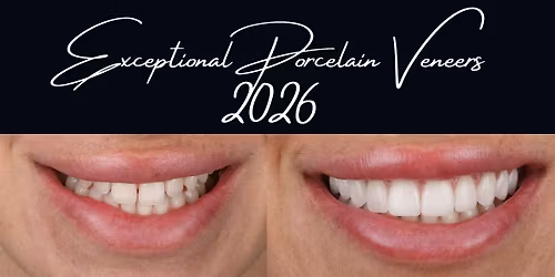 Exceptional Porcelain Veneers (EPV) Sydney