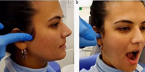 One Day Masterclass TMJ\/Sinus Headache Course 22nd March 2026