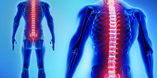 Metastatic Spinal Cord Compression Study Day