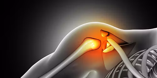 Shoulder Pain Workshop - November 12
