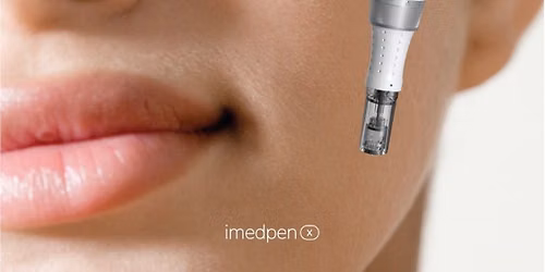 \u26a1\ufe0fADVANCED MICRONEEDLING WEEK \u26a1\ufe0f