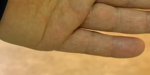 Spesials\u00f8k | Asker| Poverud Poter