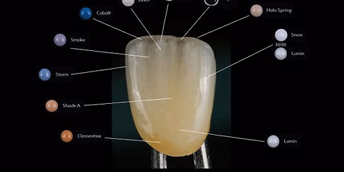 Monolithic restorations- Miyo liquid ceramic and Amann Girrbach Bion zr.