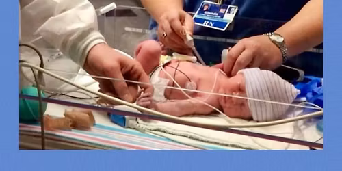 Botox Party for Glenda\u2019s Memorial Room