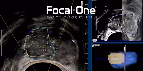 Focal Therapy Expert Panel & Dinner during SUO 2025