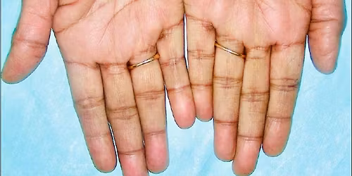 \ud83d\udd34 MASTER TUNG'S PALM DIAGNOSIS SEMINAR \u2013 MASTER CLASS  \u26d4 Registration closes June 5, 2026.