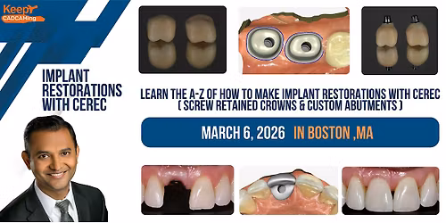 Implant Restorations with CEREC (Boston,MA)