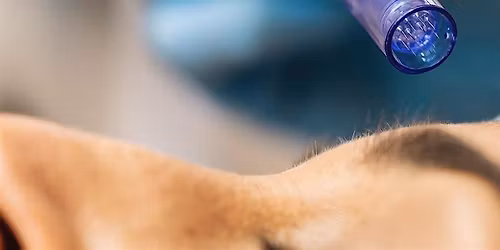 Hautverj\u00fcngung  - mit S\u00e4uren und Retinol