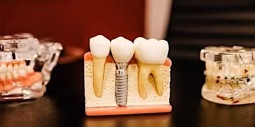 The Issue of the Tissue Around Teeth and Implants