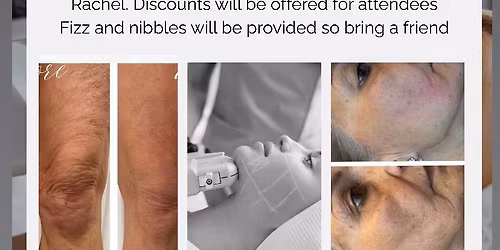 LA Beautiful Ultrason HIFU at FAB