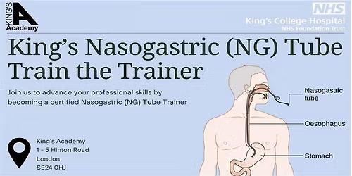 King's Nasogastric (NG) Tube Train  the Trainer