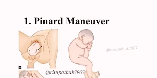 Norcet Mains Exam 2025 IBQs Discussion 