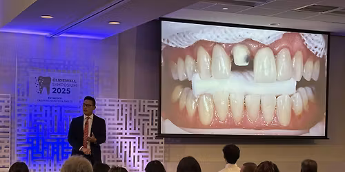 Esthetics: Creating Beautiful Smiles