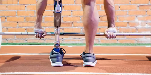 Osseointegration: A New Era of Prosthetic Care