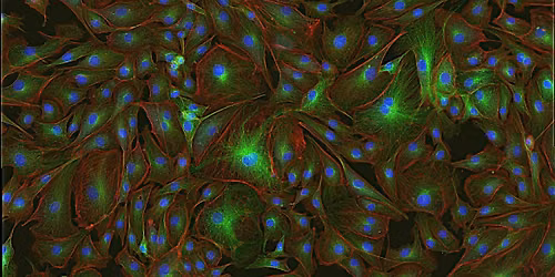 MNB: Essentials in Microscopy - From sample preparation to fluorescence