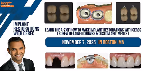Implant Restorations with CEREC (Boston,MA)