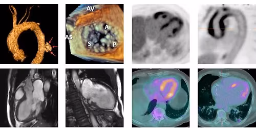 PHA Cardiovascular Imaging Sessions
