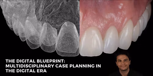 The Digital Blueprint: Multidisciplinary Case Planning in the Digital Era with Amiram Avitan