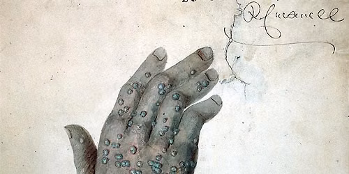 WALKING TOUR To Vax or Not To Vax: Smallpox in Early Boston