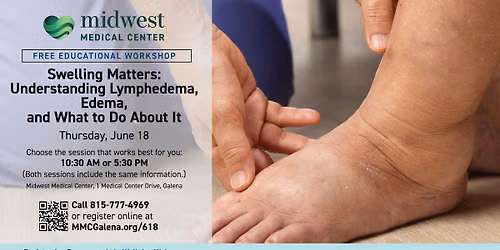 FREE WORKSHOP: Swelling Matters: Understanding Lymphedema, Edema, and What to Do about it
