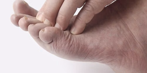 Diabetes Footcare - 2 day Virtual Program - November  3 & 4, 2026