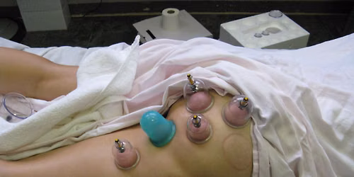 Professional Cupping Therapies