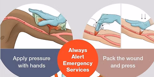 Stop the Bleed Class
