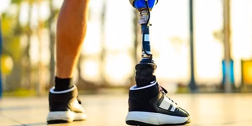 Bundaberg Amputee Social Catch Up