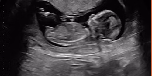 Preparing for baby Lilah