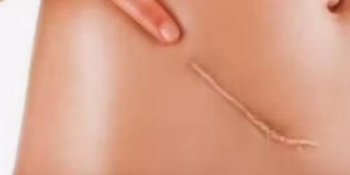 \u041e\u0441\u0442\u0435\u043e\u043f\u0430\u0442\u0438\u0447\u043d\u0438 \u0444\u0430\u0441\u0446\u0438\u0430\u043b\u043d\u0438 \u043a\u043e\u0440\u0435\u043a\u0446\u0438\u0438. \u041a\u043e\u0440\u0435\u043a\u0446\u0438\u044f \u043d\u0430 \u0448\u0435\u0432\u043e\u0432\u0435 \u0438 \u0441\u0440\u0430\u0432\u0441\u0442\u0432\u0430\u043d\u0438\u044f. \u0421\u0442\u0440\u0430\u0442\u0435\u0433\u0438\u044f \u0438 \u0432\u0438\u0434\u043e\u0432\u0435