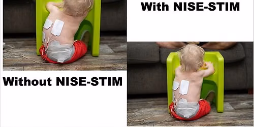 ELEKTROSTYMULACJA RDZENIOWA - NISE-STIM