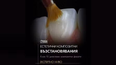 \u0415\u0441\u0442\u0435\u0442\u0438\u0447\u043d\u0438 \u043a\u043e\u043c\u043f\u043e\u0437\u0438\u0442\u043d\u0438 \u0432\u044a\u0437\u0441\u0442\u0430\u043d\u043e\u0432\u044f\u0432\u0430\u043d\u0438\u044f - \u041a\u043b\u0430\u0441 IV, \u0414\u0438\u0430\u0441\u0442\u0435\u043c\u0438, \u041a\u043e\u043c\u043f\u043e\u0437\u0438\u0442\u043d\u0438 \u0424\u0430\u0441\u0435\u0442\u0438