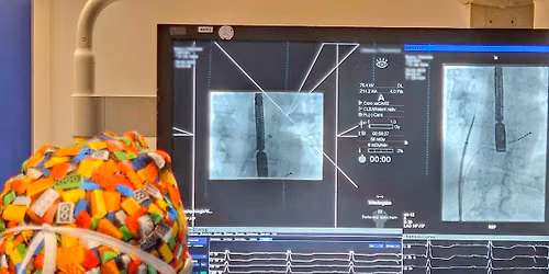 Vortrag: Moderne Behandlung von Herzrhythmusst\u00f6rungen: Kryoablation verst\u00e4ndlich erkl\u00e4rt