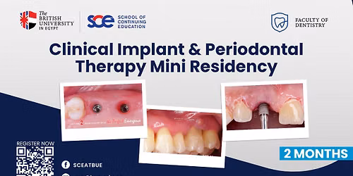 Clinical Implant & Periodontal Therapy Mini Residency Program