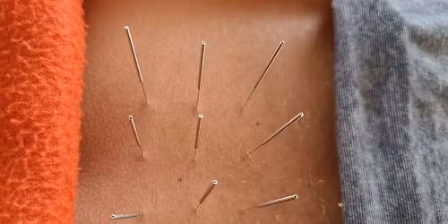 Immersion en Clinique d'Acupuncture