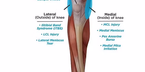 KNEE CLINIC: Knee Injuries and Health, Hands-On (for Contact Improvisers)