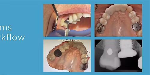 Integrating Surgical and Restorative Teams Through Digital Workflow