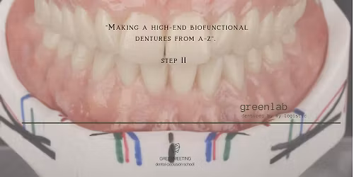 Wykonanie protezy high-end STEP II